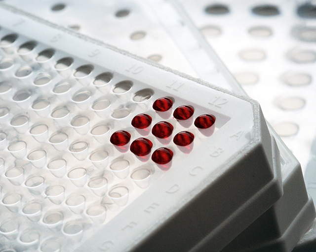Durch Strukturierung der Oberfläche in Kombination mit einer ortsselektiven Funktionalisierung können die in PCR-Tests eingesetzten Folien vollständig und dauerhaft benetzbar gemacht werden.