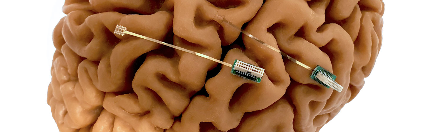 Demonstrator for neuro­-transplants for the identification of epileptogenic tissue.